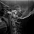 Younger generations are growing horns in the back of their head